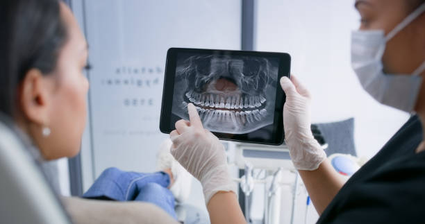 Licensed Teeth Whitening service in St. Clair County County, MO - Smile Center Dentistry